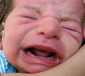Ankyloglossia is most visible when baby is crying