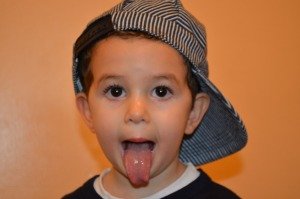 After frenotomy After frenotomy