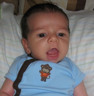 Ankyloglossia prevents the tongue from protruding outside of the mouth Ankyloglossia prevents the tongue from protruding outside of the mouth